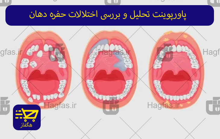 پاورپوینت تحلیل و بررسی اختلالات حفره دهان