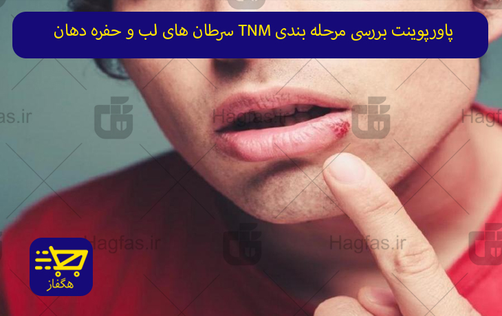 پاورپوینت بررسی مرحله بندی TNM سرطان های لب و حفره دهان